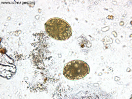 Figure 1. <i>Diphyllobothrium latum</i> ova.