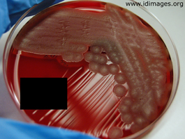 Figure 2.  <i>Bacillus cereus</i> group (not <i>anthracis</i>), on trypticase soy agar (TSA) with sheep blood.