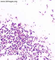 Figure 1.  Gram stain of <i>Actinobaculum schaalii</i>.