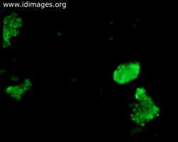 Figure 1.  DFA of nasal specimen for measles virus (1000x magnification).